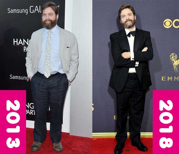 Zach Galifianakis weight loss, before and after, fat thin